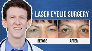 Laser Eyelid Surgery | Mrs. Villa's Testimonial