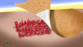 Painless bandage removal