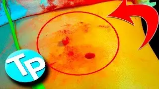 ЧТО БУДЕТ ЕСЛИ СКОВЫРНУТЬ РОДИНКУ что делать если сковырнул родинку