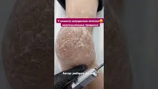 Грамотная работа над пятками🫡 Автор: pediqure_by_ana 