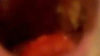 More of my mouth