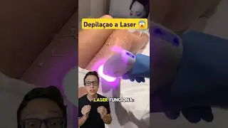 Laser Hair Removal 😱