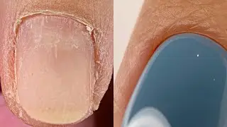 3 СЕКРЕТА чистого маникюра😍Как не перепилить точки вроста💅Гель лак