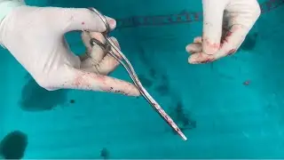 How to hold a surgical instrument in the correct manner