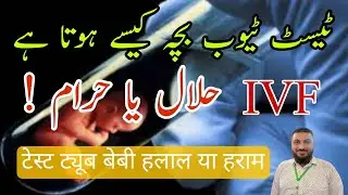 test tube baby Halal Haram | IVF | infertility
