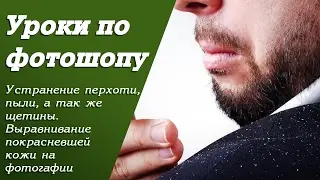 Устранение перхоти и пыли с фотографии. Выравнивание тона кожи | Уроки по фотошопу. Занятие 14
