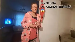 ЛЮДМИЛА В СЛЕЗАХ 😷 ОГРОМНАЯ ОПУХОЛЬ НА ЖИВОТЕ 😱 СРОЧНО К ВРАЧУ . СУПЕРПРИЗ ВОЛОДЕ
