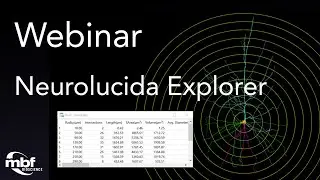 Webinar: Q&A Session on the Quantitative Analysis Capabilities of Neurolucida Explorer