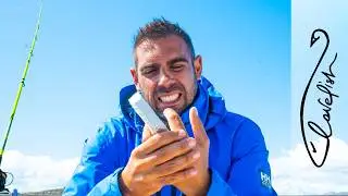 I almost lost a FINGER…my ACCIDENT…
