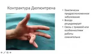 Обзорная лекция о частых болезнях в практике кистевого хирурга. Рассказывает Николай Карпинский.