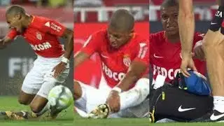 Kylian Mbappe Injury vs Toulouse