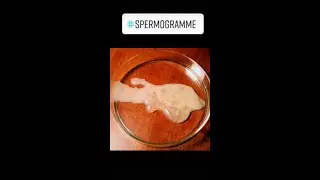 Did you know sperm can be seen in a microscope? #shorts