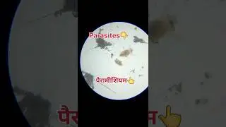 पैरामीशियम और parasites in microscop // पैरामीशियम को microscop me कैसे dekhe