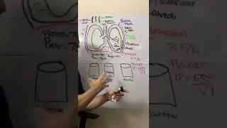 Understanding Chest Tubes and the 3 Bottle System Trim