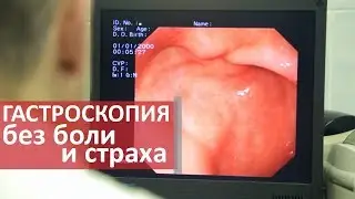 Эндоскопия без боли. 💡 Как сделать эндоскопию без боли и страха. Центр Диагностика