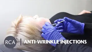 Anti-Wrinkle Injections Treatment | RCA Sydney Clinic