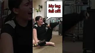 Amputee’s Leg FALLS OFF!!! 🦵 😱