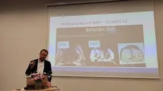 Prostatos vėžys. Prevencija, diagnostika ir gydymas