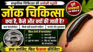 जोंक चिकित्सा क्या और कैसे होती है || leech therapy kya hai || leech therapy kaise hoti hai