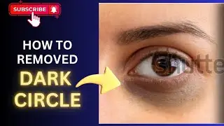 How to Remove Dark Circle in Adobe Photoshop #photoshopcc#video