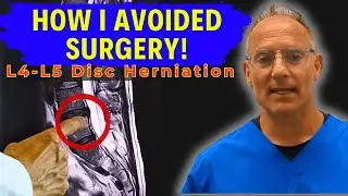 L4-L5 Disc Herniation: They Said Surgery Was My Only Option…Until I Tried This
