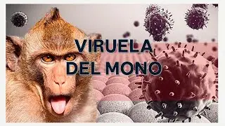 CAPACITACION VIRUELA DEL MONO - Monkey-pox 2022