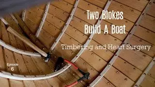 Timbering and Open Heart Surgery (Ep.6.) Two Blokes Build A Boat.