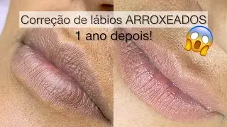 Correção de lábios roxos