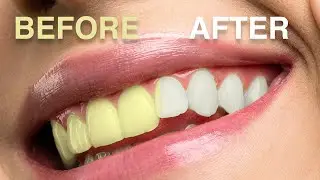 TEETH WHITENING EASY PHOTOSHOP TUTORIAL