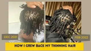 MY LOCS WERE BREAKING OFF AT THE ROOT || HOW I GREW BACK MY HAIR || TIPS FOR THINNING LOCS