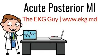 Acute Posterior MI on EKG / ECG l The EKG Guy - www.ekg.md