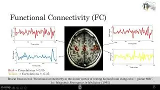 Resting-state Functional Connectivity analysis Individual differences, Schizophrenia classification