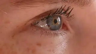 fique atento aos sinais da diabetes tipo 2