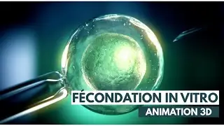 Fécondation In Vitro (FIV) - ICSI | Animation 3D