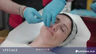 Biofiller: Speciale Medicina Puglia - Dott. Arturo Amoroso