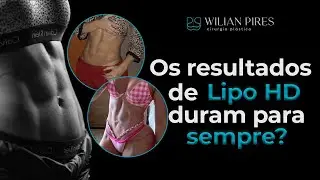 Como fica o resultado de Lipo HD | Dr. Wilian Pires