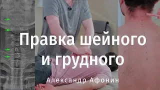 Correction of the cervical and thoracic spine: compensation from the neck to the chest and the so...