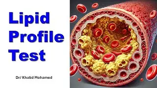 Lipid Profile Test. تحليل نسبة الدهون بالدم #explore #trending #شرح_بالعربي
