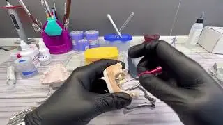 Alpha Bio implants#стоматология#ярославль#зубы