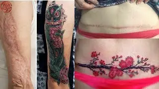 Wonderful Tattoos That Turn Scars Into Works Of Art #2