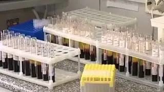 Бесплатный тест на холестерин и сахар крови могут пройти жители Череповца