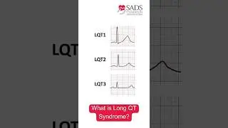 What is Long QT Syndrome?