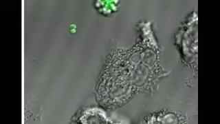 Phagocytosis of MRSA by a human neutrophil