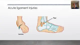 Biomechanics: Tendon & Ligament Injury