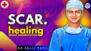 Scar Healing - Sub Glandular vs Sub Muscular IMPLANTS