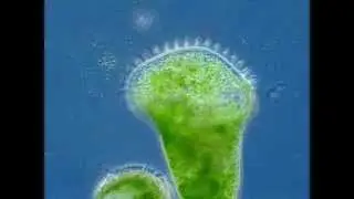Stentor polymorphus