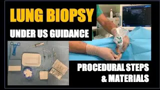 US-guided Lung Biopsy: procedural steps and material