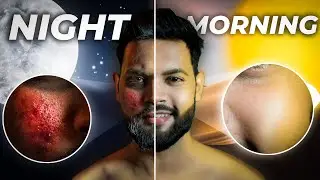 Night Skin Care Routine Every Man Should Follow!😍 | GLOWING SKIN