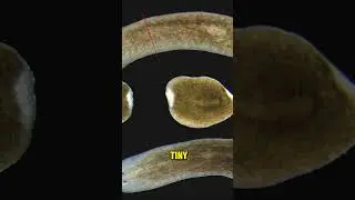 How Planarians Are So Unique