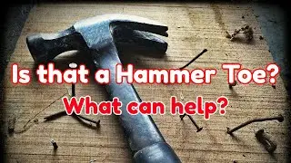 How to use a Budin Splint for Hammer Toe - Dr Nail Nipper (2020)
